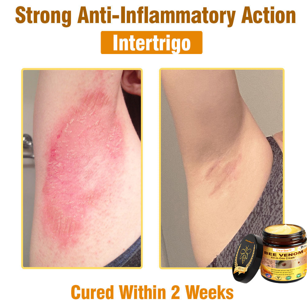 ClearBee™ Bee Venom All-in-One Cream US Dermatologist Approved🐝