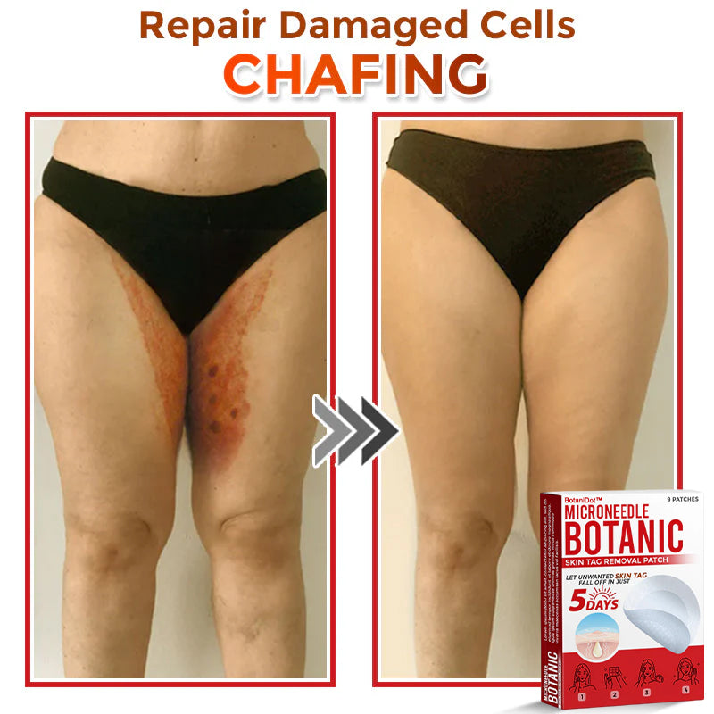 🌈BotaniDot™ MicroNeedle Botanic Skin Tag Removal Patch 🇺🇸 Made in the USA