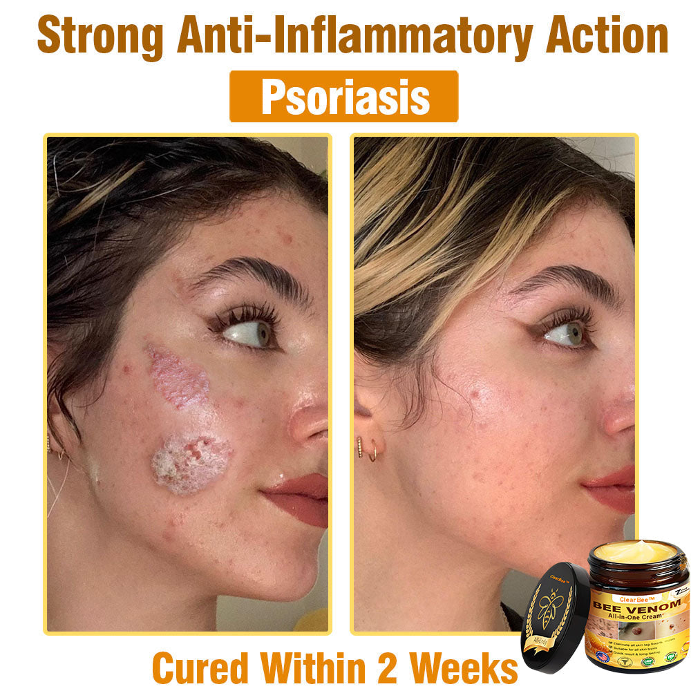ClearBee™ Bee Venom All-in-One Cream US Dermatologist Approved🐝