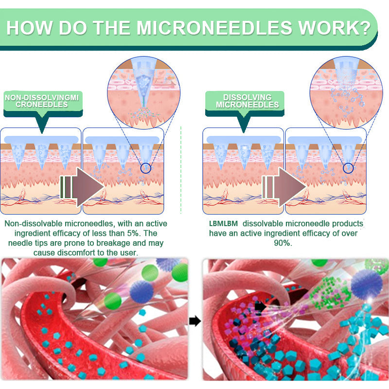 【Last Day Promotion 80% OFF🔥】LBMLBM™ NIDDK-Tirzepatide Slimming & health NANO MICRONEEDLE PATCH🇺🇸👨⚕️(Zero Pain, 24/7 Release | Lose 20lbs FAST | 90% Sugar Drop | )🔥🎁