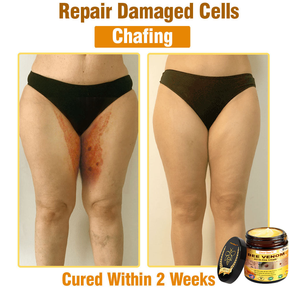ClearBee™ Bee Venom All-in-One Cream US Dermatologist Approved🐝