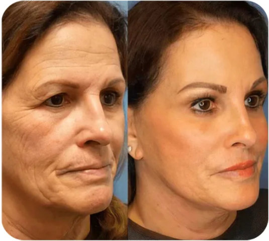 Dermaliftix™ Instant Blurring & Tightening Primer