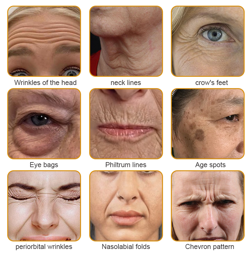 LOVILDS™ Botox Bee Venom Wrinkle Removal Cream