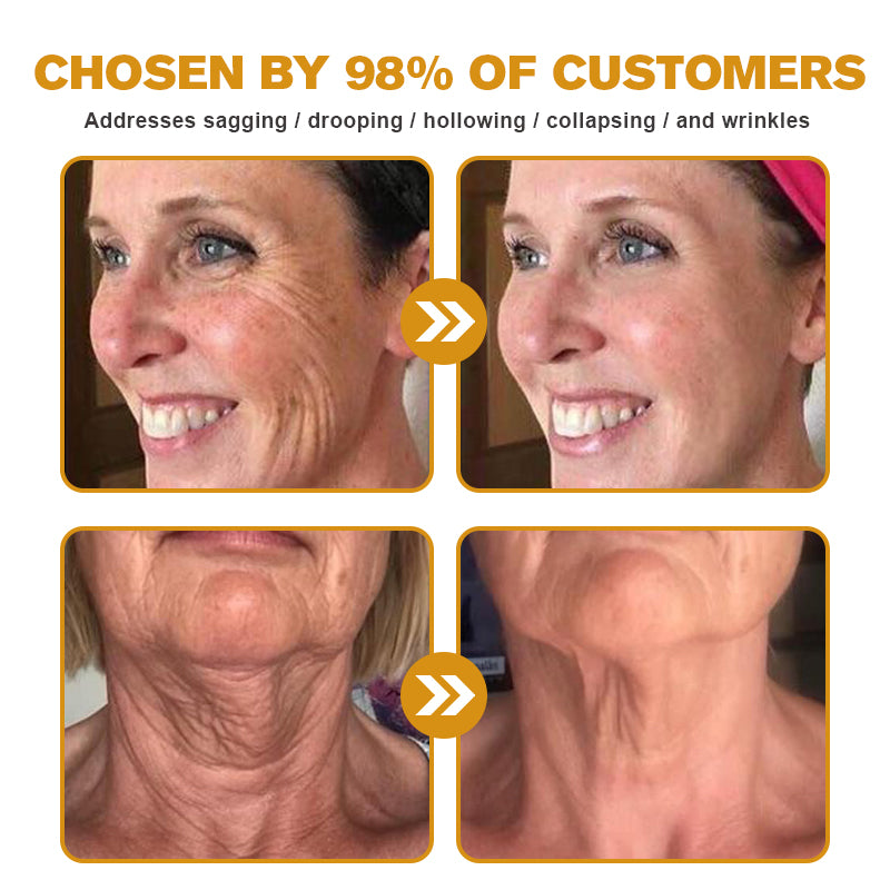 LOVILDS™ Botox Bee Venom Wrinkle Removal Cream