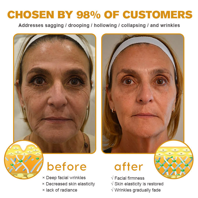 LOVILDS™ Botox Bee Venom Wrinkle Removal Cream
