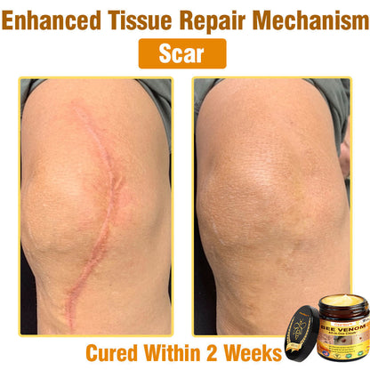 ClearBee™ Bee Venom All-in-One Cream US Dermatologist Approved🐝