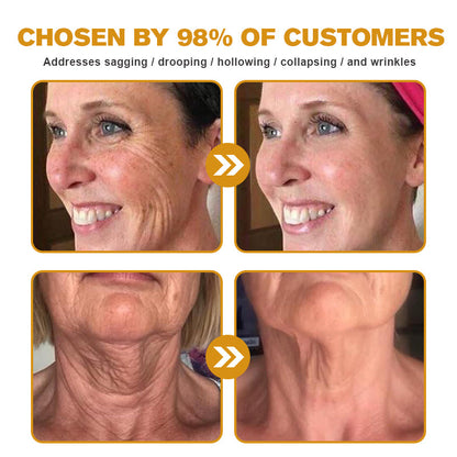 LOVILDS™ Botox Bee Venom Wrinkle Removal Cream