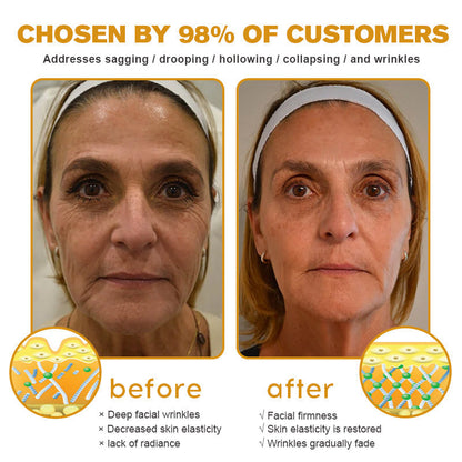 LOVILDS™ Botox Bee Venom Wrinkle Removal Cream